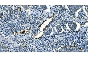 IHC analysis of IDH2 using anti-IDH2 antibody (ABIN7602786).