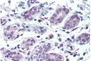 Immunohistochemistry (IHC) image for anti-ATP-Binding Cassette, Sub-Family B (MDR/TAP), Member 5 (ABCB5) (AA 1-30) antibody (ABIN1804042)