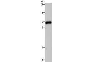 Gel: 8 % SDS-PAGE, Lysate: 40 μg, Lane: Human kidney tissue, Primary antibody: ABIN7191664(NMT1 Antibody) at dilution 1/200, Secondary antibody: Goat anti rabbit IgG at 1/8000 dilution, Exposure time: 3 minutes (NMT1 抗体)