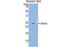 Western Blotting (WB) image for anti-Cathelicidin Antimicrobial Peptide (CAMP) (AA 31-170) antibody (Biotin) (ABIN1175686) (Cathelicidin 抗体  (AA 31-170) (Biotin))