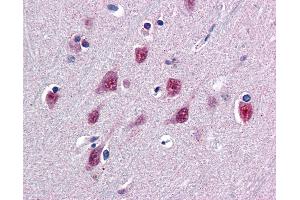 Anti-SMUG1 antibody IHC of human brain, cortex. (SMUG1 抗体  (AA 2-14))