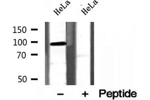 Western blot analysis of extracts of HeLa cells, using PYGL antibody. (PYGL 抗体  (Internal Region))