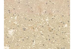 ABIN6257849 and ABIN6275297 at 1/100 staining human glioblastoma by IHC-P. (NXPH3 抗体  (Internal Region))