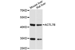 Western blot analysis of extracts of various cell lines, using ACTL7B antibody (ABIN6291741) at 1:3000 dilution. (Actl7b 抗体)