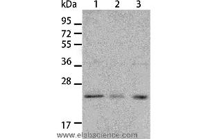 Western blot analysis of A431 and A172 cell, human liver cancer tissue, using BNIP1 Polyclonal Antibody at dilution of 1:550 (BNIP1 抗体)