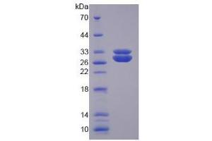 SDS-PAGE analysis of Human SOD3 Protein. (SOD3 蛋白)