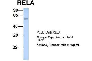 Host: Rabbit  Target Name: RELA  Sample Tissue: Human Fetal Heart  Antibody Dilution: 1.
