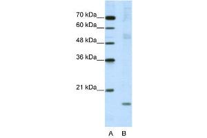 WB Suggested Anti-NIP7  Antibody Titration: 5. (NIP7 抗体  (C-Term))