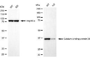 Western blotting analysis using calcium binding protein 39 antibody (ABIN7797828).