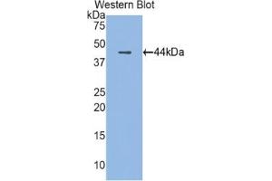 Detection of Recombinant CAMP, Rat using Polyclonal Antibody to Cathelicidin Antimicrobial Peptide (CAMP) (Cathelicidin 抗体  (AA 30-175))