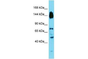 Host: Rabbit Target Name: SYDE2 Sample Type: Fetal Liver lysates Antibody Dilution: 1. (SYDE2 抗体  (C-Term))