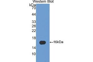 Detection of Recombinant FABP5, Human using Polyclonal Antibody to Fatty Acid Binding Protein 5 (FABP5) (FABP5 抗体  (AA 2-135))