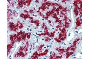 VEZF1 antibody was used for immunohistochemistry at a concentration of 4-8 ug/ml. (VEZF1 抗体  (Middle Region))
