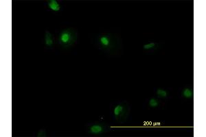 Immunofluorescence of monoclonal antibody to RUNX1 on HeLa cell.