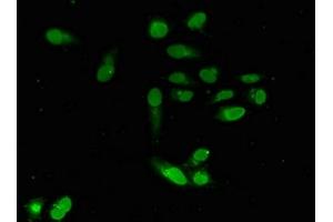 Immunofluorescent analysis of Hela cells using ABIN7151606 at dilution of 1:100 and Alexa Fluor 488-congugated AffiniPure Goat Anti-Rabbit IgG(H+L) (Emerin 抗体  (AA 1-222))