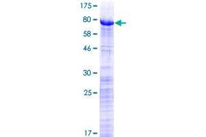 PRPF31 Protein (AA 1-499) (GST tag)