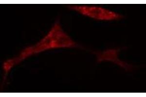 Immunofluorescence (fixed cells) (IF/ICC) image for anti-Cell Division Cycle Associated 2 (CDCA2) (Internal Region) antibody (ABIN6258502)