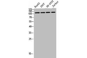 Western blot analysis of SW480 MCF7 lysate, antibody was diluted at 500. (DAAM1 抗体  (AA 400-500))