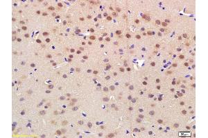 Formalin-fixed and paraffin embedded rat brain labeled with Rabbit Anti NRF-1 Polyclonal Antibody, Unconjugated (ABIN675219) at 1:200 followed by conjugation to the secondary antibody and DAB staining (NRF1 抗体  (AA 51-180))