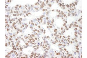 Immunohistochemistry (IHC) image for anti-B-Cell CLL/lymphoma 11B (Zinc Finger Protein) (BCL11B) (C-Term) antibody (ABIN7448431)