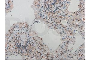 Formalin-fixed and paraffin-embedded rat aortic tissue labeled with Rabbit Anti-NFKB p65 Polyclonal Antibody (ABIN668961), Unconjugated at 1:600 followed by conjugation to the secondary antibody and DAB staining (NF-kB p65 抗体  (AA 51-100))