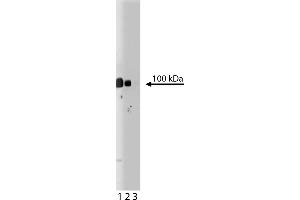 Western Blotting (WB) image for anti-Plakophilin 2 (PKP2) (AA 19-183) antibody (ABIN968178) (Plakophilin 2 抗体  (AA 19-183))