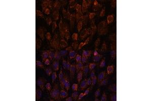 Immunofluorescence analysis of C6 cells using NSDHL antibody (ABIN7268794) at dilution of 1:100. (NSDHL 抗体  (AA 1-240))