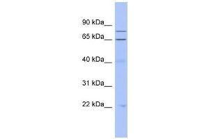 ZNF431 antibody used at 0. (ZNF431 抗体  (Middle Region))