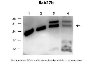 WB Suggested Anti-Rab27b Antibody Titration: 0. (RAB27B 抗体  (C-Term))