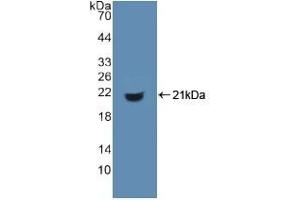Detection of Recombinant MHCDG, Human using Polyclonal Antibody to Cluster Of Differentiation 74 (CD74) (CD74 抗体  (AA 64-205))
