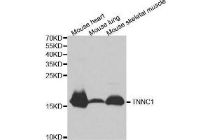 Western blot analysis of extracts of various cell lines, using TNNC1 antibody. (TNNC1 抗体  (AA 1-160))