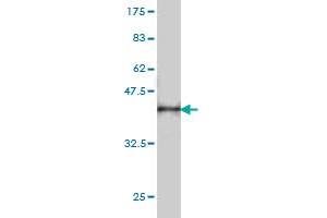Western Blot detection against Immunogen (36. (DNM2 抗体  (AA 611-710))