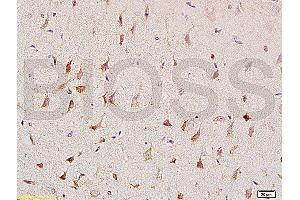 Formalin-fixed and paraffin embedded: rat brain tissue labeled with Anti-CNP/CNPase Polyclonal Antibody (ABIN730738), Unconjugated at 1:200, followed by conjugation to the secondary antibody and DAB staining (Cnpase 抗体  (AA 151-250))