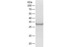 Western Blotting (WB) image for Mitochondrial Trans-2-Enoyl-CoA Reductase (MECR) (AA 54-373) protein (His tag) (ABIN7123988) (MECR Protein (AA 54-373) (His tag))