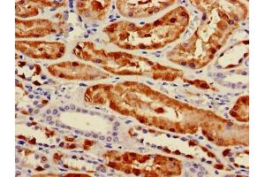 Immunohistochemistry of paraffin-embedded human kidney tissue using ABIN7163258 at dilution of 1:100 (PCK1 抗体  (AA 1-622))