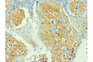 Immunohistochemistry of paraffin-embedded human tonsil tissue using ABIN7171381 at dilution of 1: 100 (CD3D 抗体  (AA 22-105))