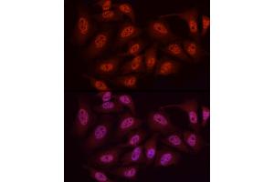 Immunofluorescence analysis of HeLa cells using WTAP Rabbit pAb (ABIN7271372) at dilution of 1:50 (40x lens). (WTAP 抗体  (AA 1-396))