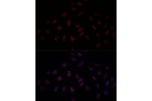 Immunofluorescence analysis of U-2 OS cells using BRC antibody (1318) at dilution of 1:100. (BRCA1 抗体  (AA 400-699))