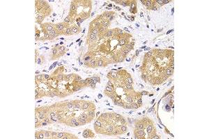 Immunohistochemistry of paraffin-embedded human kidney using RPS4X antibody. (RPS4X 抗体  (AA 66-263))