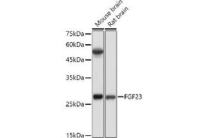 Western blot analysis of extracts of various cell lines, using FGF23 antibody (ABIN6127894, ABIN6140600, ABIN6140602 and ABIN6221721) at 1:500 dilution. (FGF23 抗体  (AA 25-251))