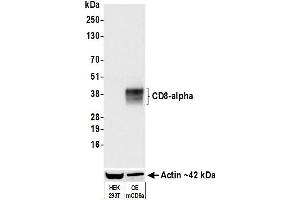 Western Blotting (WB) image for anti-CD8a Molecule (CD8A) (AA 28-194) antibody (ABIN7453877)