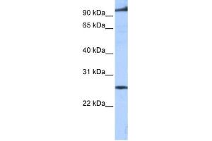 Western Blotting (WB) image for anti-Phosphatidic Acid Phosphatase Type 2 Domain Containing 1B (PPAPDC1B) (Middle Region) antibody (ABIN2784039)