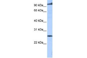 WB Suggested Anti-PPAPDC1B Antibody Titration:  0. (PPAPDC1B 抗体  (Middle Region))
