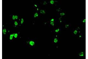 Immunofluorescent analysis of Hela cells using ABIN7139582 at dilution of 1:100 and Alexa Fluor 488-congugated AffiniPure Goat Anti-Rabbit IgG(H+L)