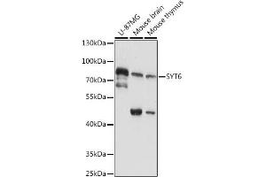Western blot analysis of extracts of various cell lines, using SYT6 antibody (ABIN7270677) at 1:1000 dilution. (SYT6 抗体  (AA 1-120))