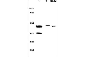 Lane 1: human colon carcinoma lysates Lane 2: mouse brain lysates probed with Anti NCF1/p47 phox Polyclonal Antibody, Unconjugated (ABIN750643) at 1:200 in 4 °C. (NCF1 抗体  (AA 151-250))