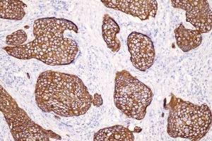 Immunohistochemistry (IHC) image for anti-Keratin 14 (KRT14) (C-Term) antibody (ABIN870552) (KRT14 抗体  (C-Term))