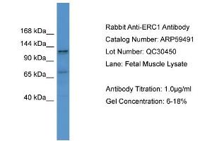 WB Suggested Anti-ERC1  Antibody Titration: 0. (ERC1 抗体  (C-Term))