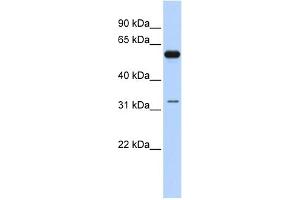 WB Suggested Anti-DDX28 Antibody Titration:  0. (DDX28 抗体  (N-Term))
