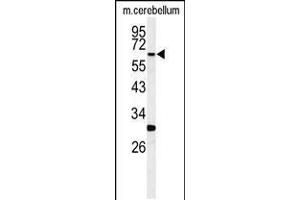 Western blot analysis of hRIPK3-E504 in mouse cerebellum tissue lysates (35ug/lane)